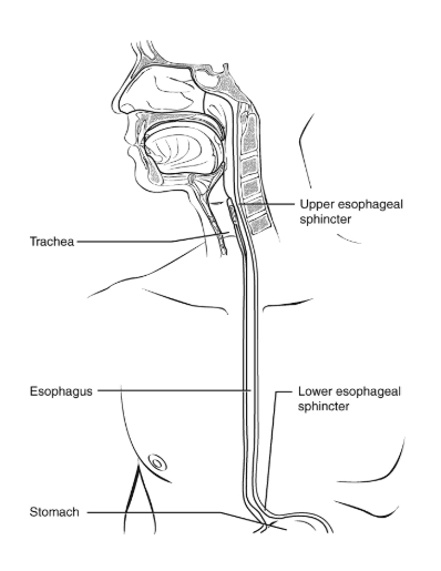 Medical illustration showing the human esophagus, including the upper and lower esophageal sphincters, trachea, and stomach, highlighting areas impacted by esophageal cancer.