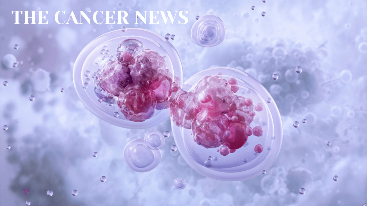 Autologous Transplant in Multiple Myeloma: Still the Standard as Quadruplet Therapy and Cellular Immunotherapy Advance