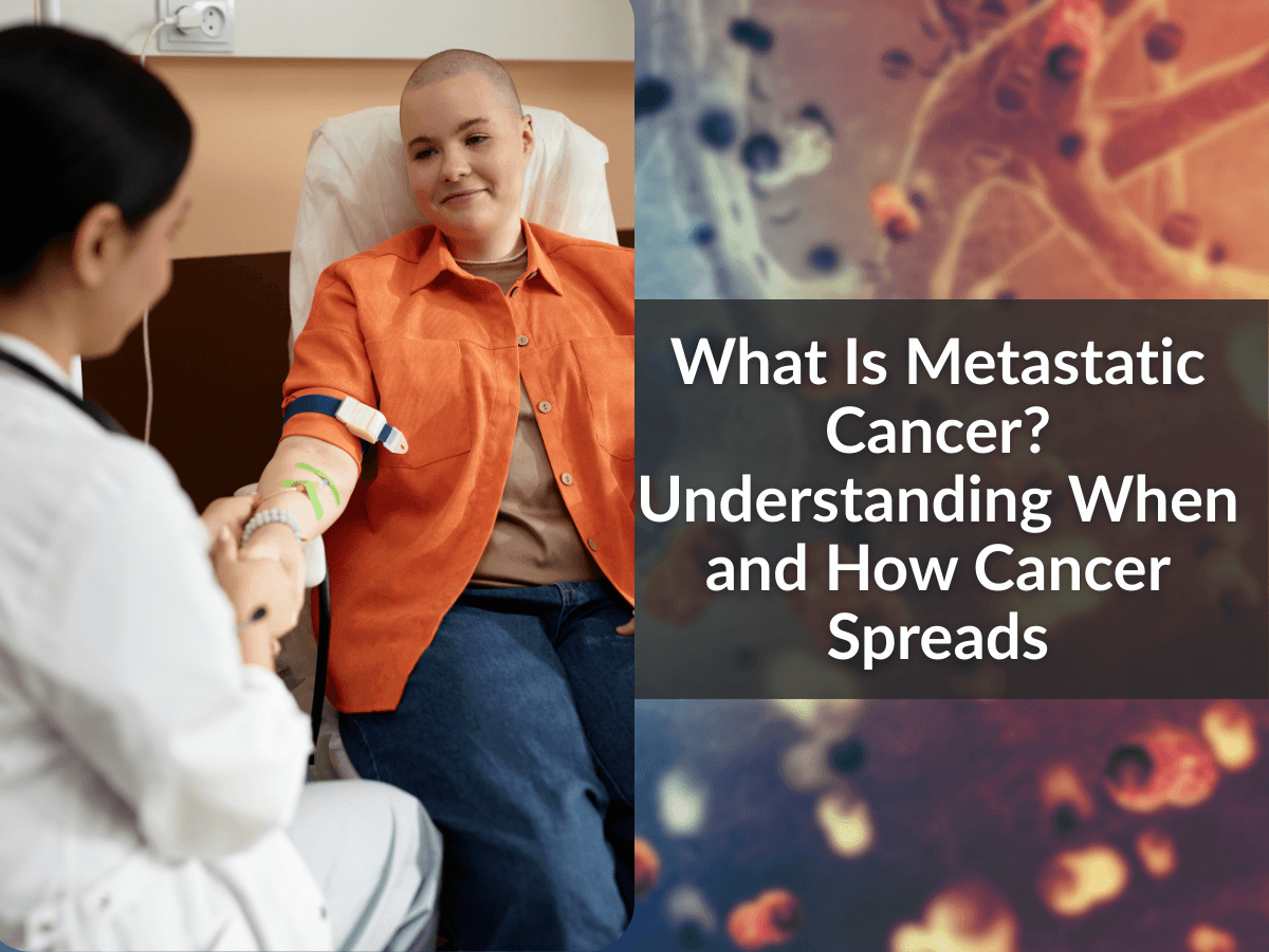 What Is Metastatic Cancer? Understanding When and How Cancer Spreads