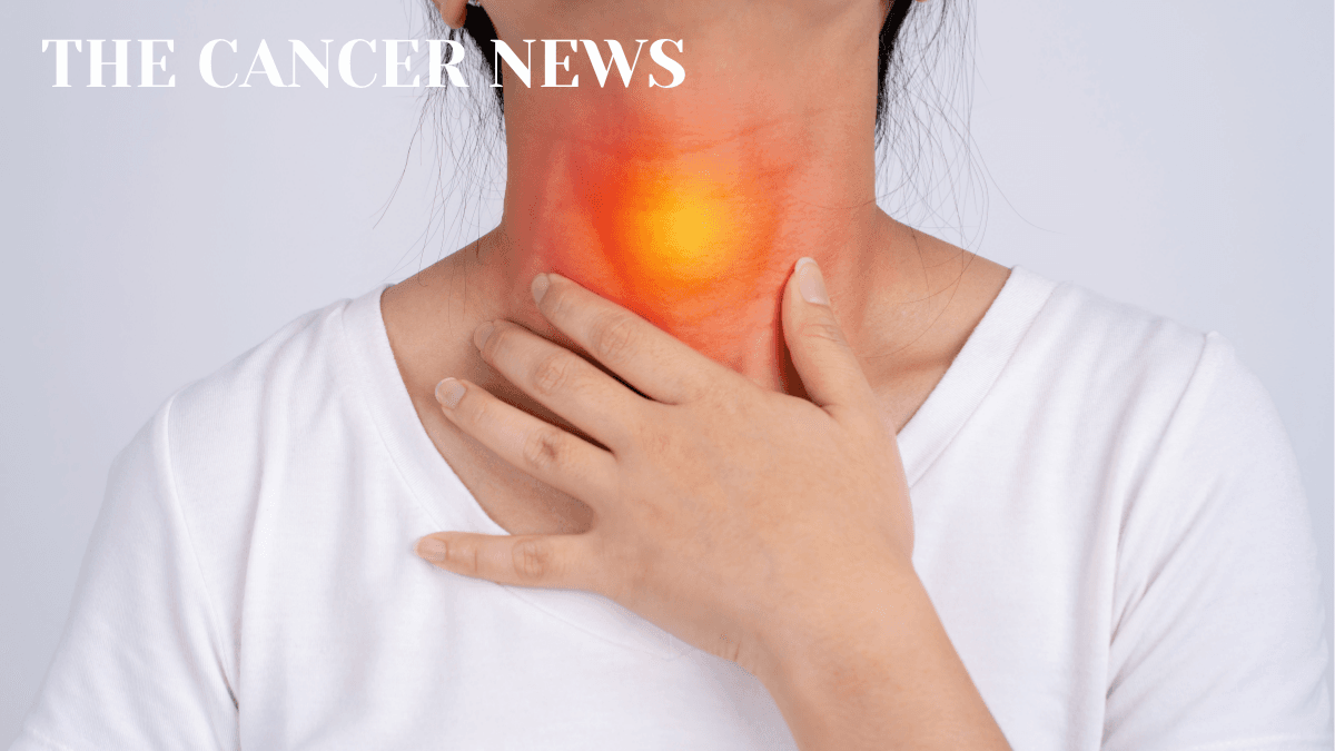 Immunotherapy Is Moving Earlier Into Head and Neck Cancer Treatment