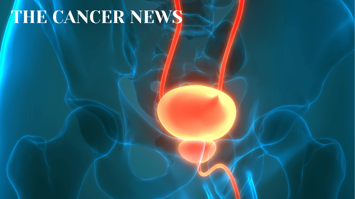 Perioperative Intensification in High-Risk Prostate Cancer: PROTEUS, TALAPRO-3, and Treatment De-Escalation