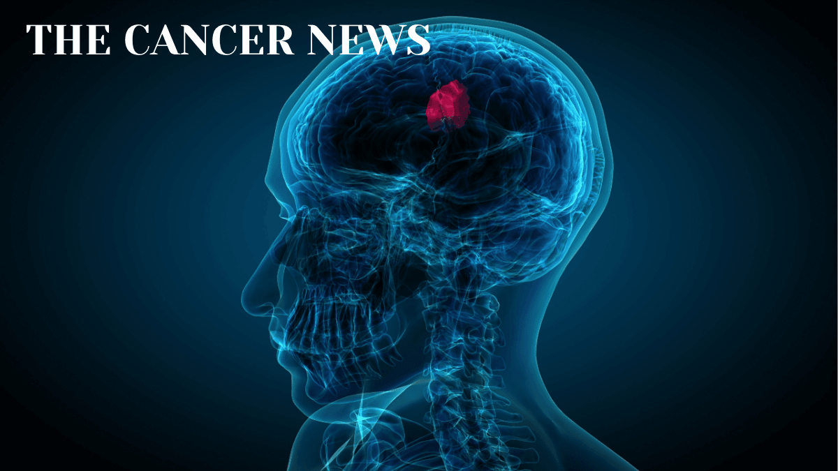 Rethinking Glioblastoma Care: Methylation Status, Tumor Treating Fields, and IDH Inhibitors
