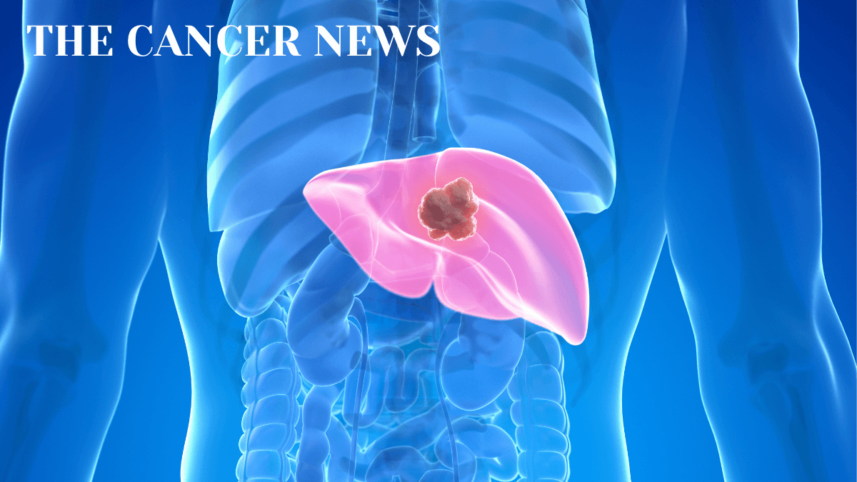 A Rare Liver Cancer in a Young Woman Underscores the Need for More Options