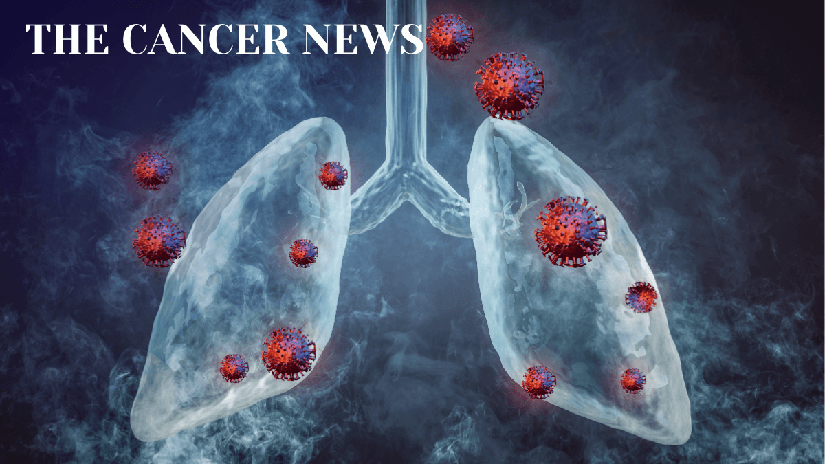 Advances in the Management of Lung Cancer in 2025 and 2026