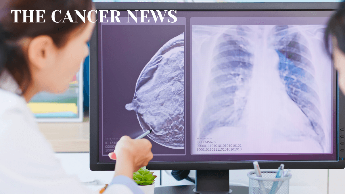 Targeting Endocrine Resistance: New Sequencing Strategies in Metastatic Breast Cancer